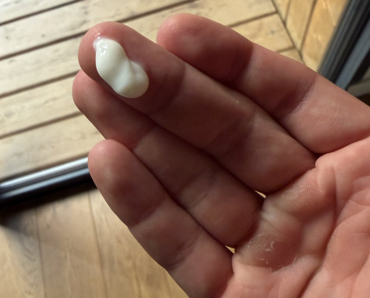 Noisette de crème réparatrice HÉLÉ sur les doigts, avec la corne et la peau qui pèle sur le côté de la paume d'une main de crossfitteur